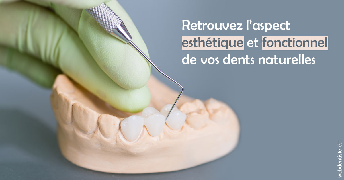 https://www.docteurs-el-khoury-hanna.fr/Restaurations dentaires 1