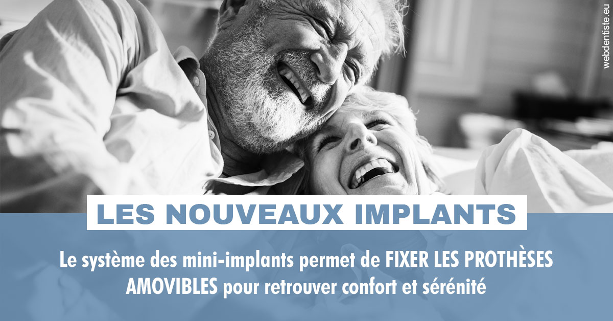 https://www.docteurs-el-khoury-hanna.fr/Les nouveaux implants 2