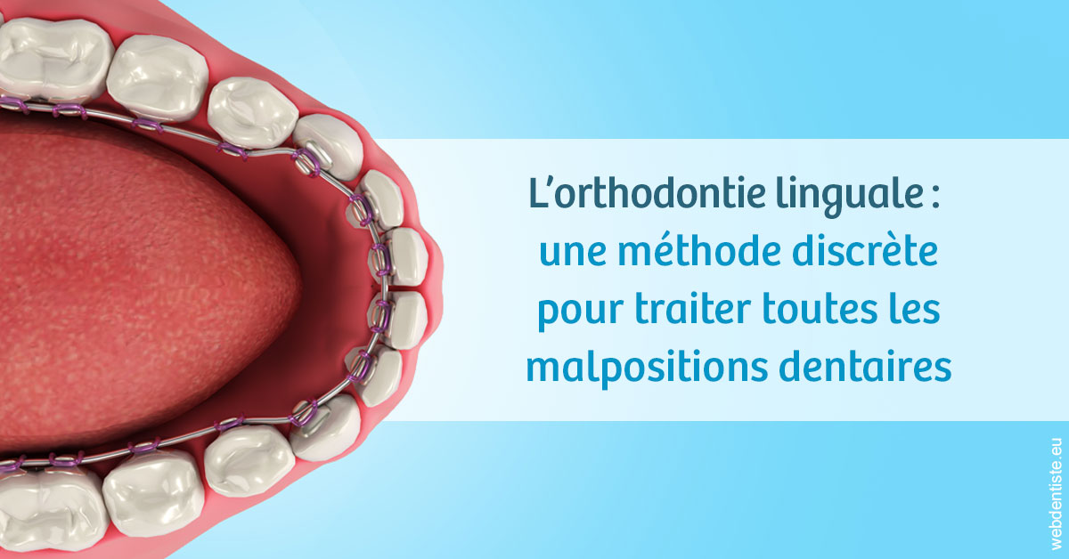 https://www.docteurs-el-khoury-hanna.fr/L'orthodontie linguale 1