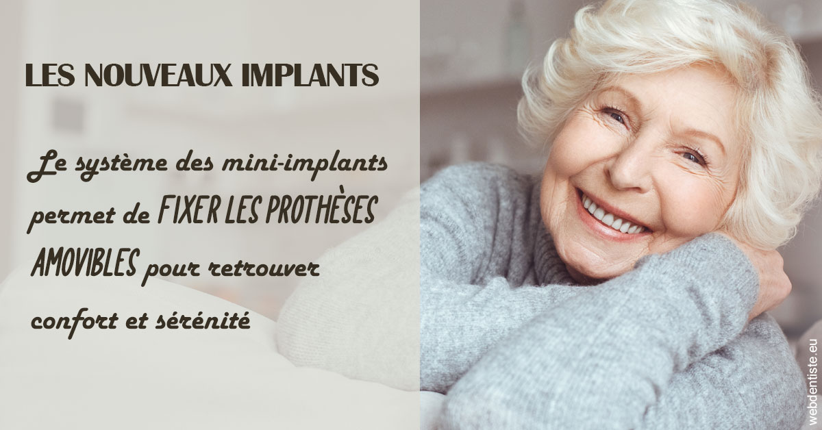 https://www.docteurs-el-khoury-hanna.fr/Les nouveaux implants 1