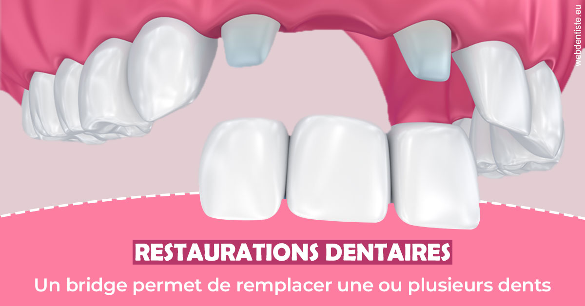 https://www.docteurs-el-khoury-hanna.fr/Bridge remplacer dents 2