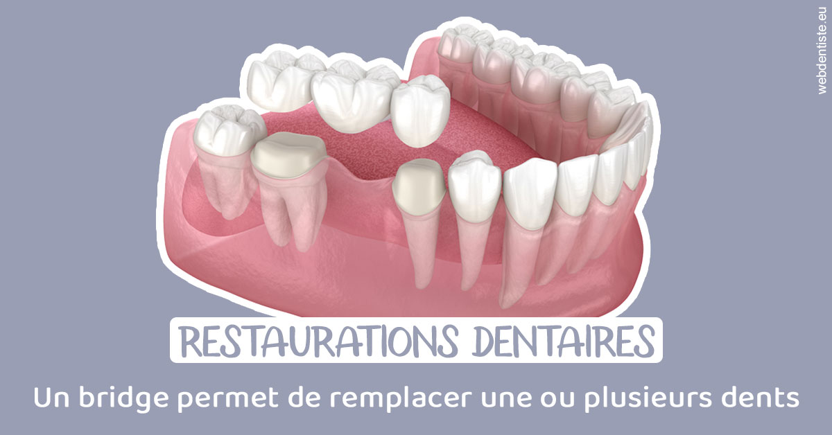 https://www.docteurs-el-khoury-hanna.fr/Bridge remplacer dents 1