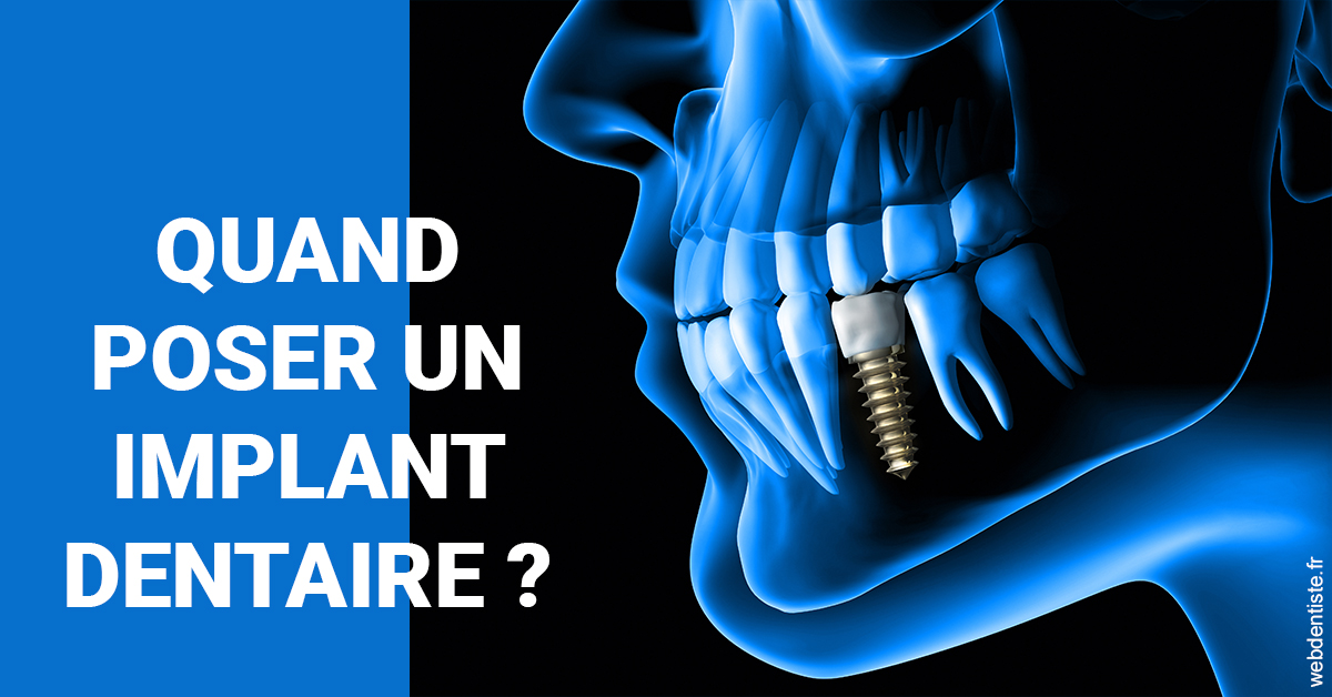 https://www.docteurs-el-khoury-hanna.fr/Les implants 1