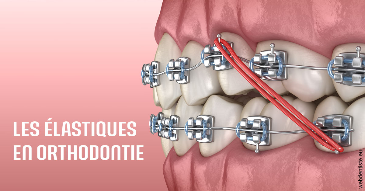 https://www.docteurs-el-khoury-hanna.fr/Elastiques orthodontie 2