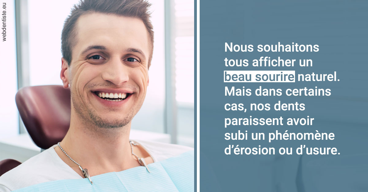 https://www.docteurs-el-khoury-hanna.fr/Érosion et usure dentaire