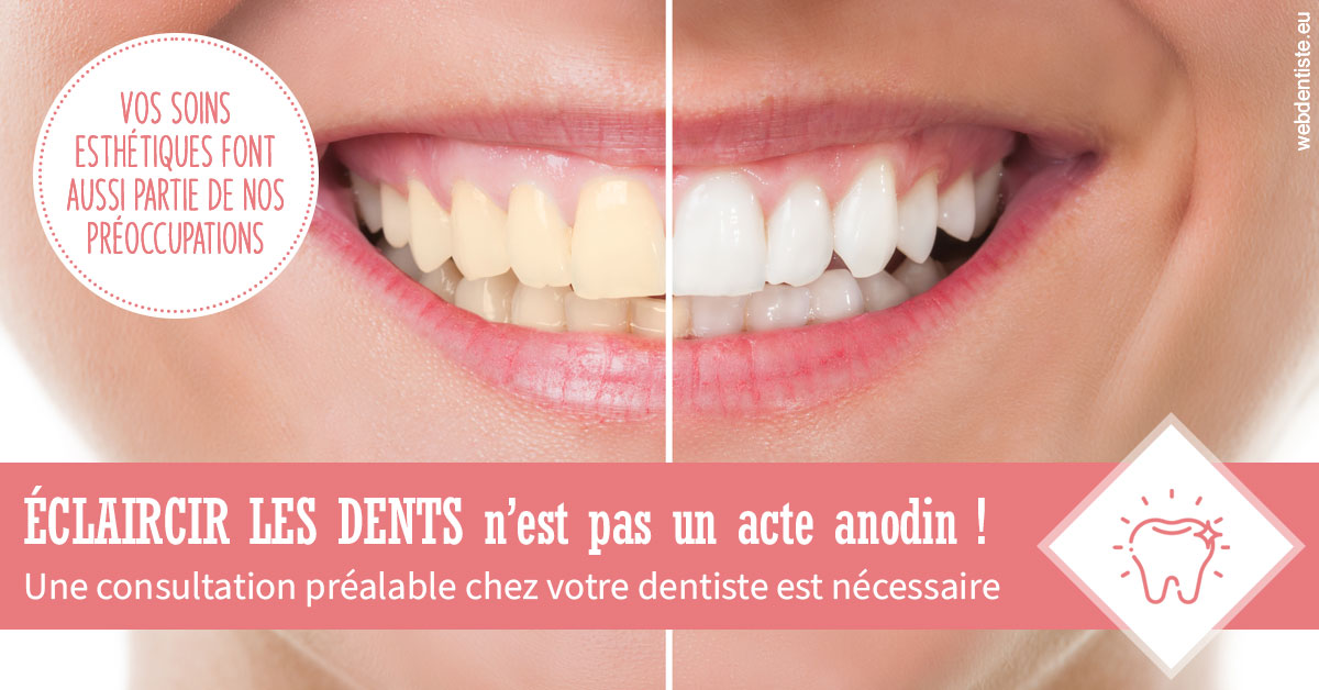 https://www.docteurs-el-khoury-hanna.fr/Eclaircir les dents 1