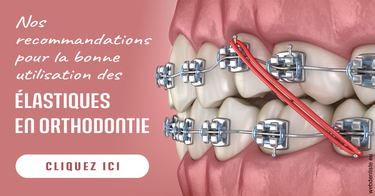 https://www.docteurs-el-khoury-hanna.fr/Elastiques orthodontie 2